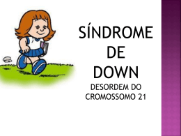 Síndrome de Down - Cromossomo 21