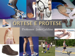 Órtese e Prótese - Universidade Castelo Branco
