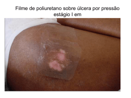 Filme de poliuretano sobre úlcera por pressão estágio I em
