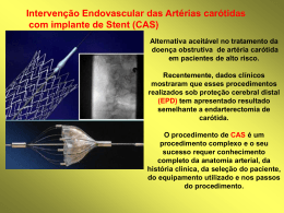 17 - Intervenção Endovascular das Artérias