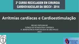 Arritmias cardíacas e Cardioestimulação
