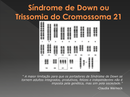 Síndrome de Down ou trissomia do cromossoma 21