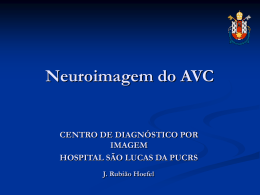 Neuroimagem do AVC