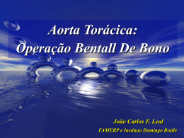 Aorta Torácica: Operação Bentall De Bono