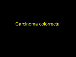 Carcinoma colorrectal esporádico