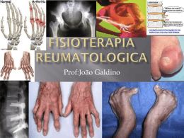 Fisioterapia Reumatologica - Universidade Castelo Branco