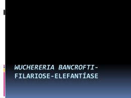 Wuchereria bancrofti- Filariose
