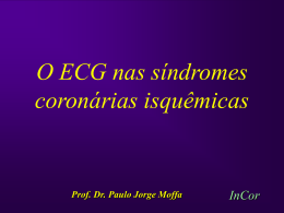 Importância do ECG na Estratificação de Risco no Infarto Agudo do