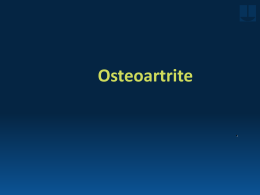 Tratamento da Osteoartrite: Antiinflamatório ou Condroproteção?