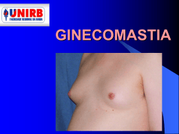 ginecomastia ocorrência de câncer de mama em homens no brasil