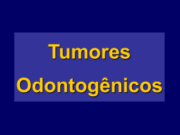 Tumores Odontogênicos