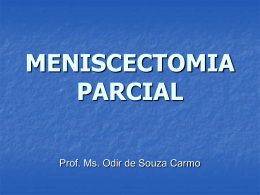 MENISCECTOMIA PARCIAL - Universidade Castelo Branco