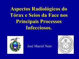 Aspectos Radiológicos do Tórax e Seios da Face nos