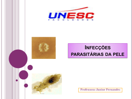 Infecções parasitárias da pele Professora: Janine Fernandes