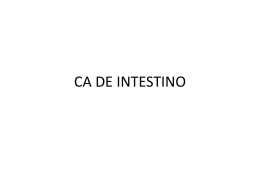CA DE PRÓSTATA - Universidade Castelo Branco