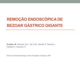 remoção endoscópica de bezoar gástrico gigante