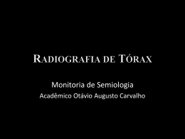 Radiografia de Tórax