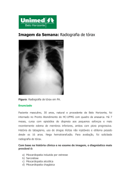 Imagem da Semana: Radiografia de tórax