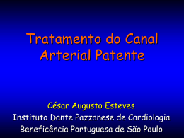 Tratamento do canal arterial patente Dr. César Augusto
