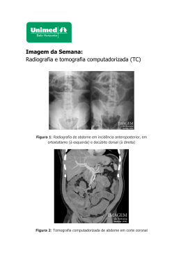 Imagem da Semana: Radiografia e tomografia computadorizada (TC)