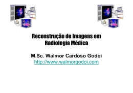 Reconstrução de Imagens em Radiologia Médica