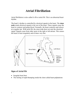 Atrial Fibrillation