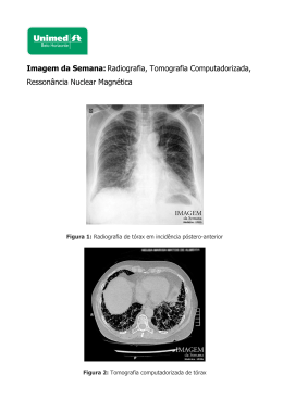 Imagem da Semana: Radiografia, Tomografia Computadorizada