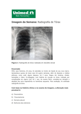 Imagem da Semana: Radiografia de Tórax