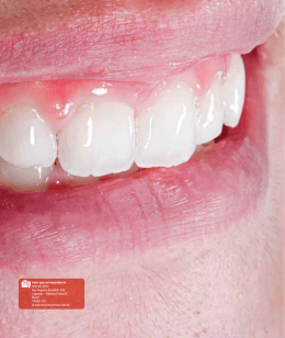 Odontologia minimamente invasiva: qual o limite?