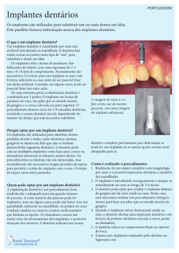 Implantes dentários