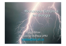 Microscopia Eletrônica em Biologia