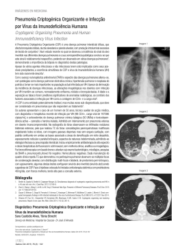 Pneumonia Criptogénica Organizante e Infecção por Vírus da