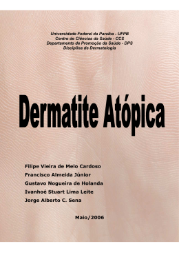 Dermatite Atópica - Luzimar Teixeira
