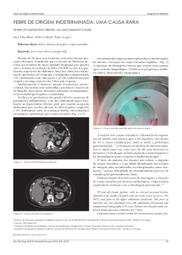 Febre de origem indeterminada - Repositório do Hospital Prof