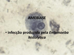 Amebíase