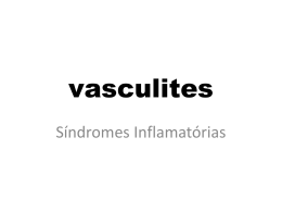 vasculites- Prof MArcos Afonso aula-12 e 13 FEV
