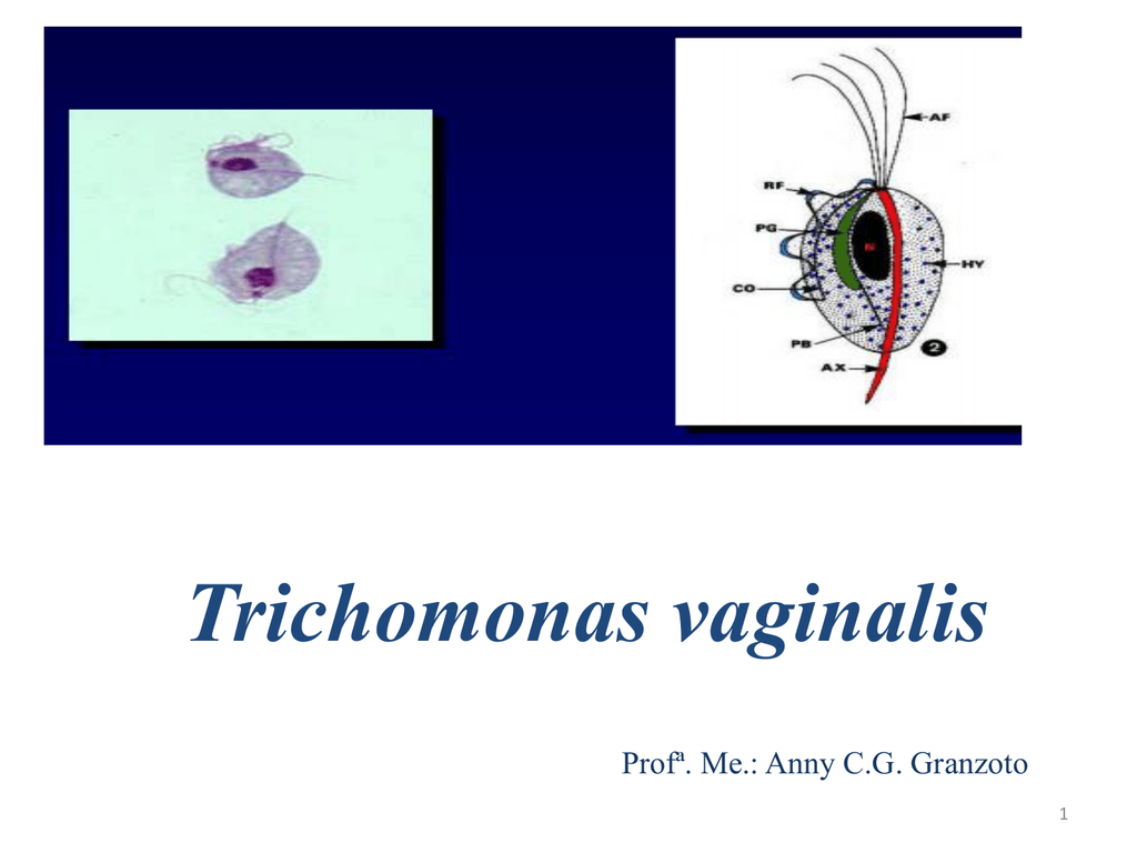 Trichomonas jele és kezelése, Nemi betegségek