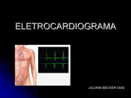 Eletrocardiograma - CEM-HUSJ