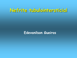 Nefrite intersticial aguda (NIA)