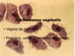 Tricomonas vaginalis