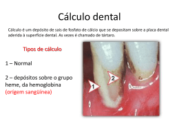 Cálculo dental