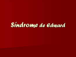 Síndrome de Edward - Luiz Soares Andrade
