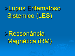 Ressonância Magnética no LES Dr. Marcos