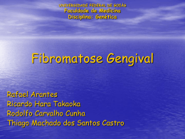 Fibromatose Gengival Hereditária-FGH
