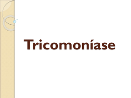 Tricomoníase