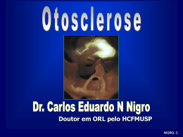 Otosclerose clínica