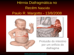 Hérnia diafragmática (Apresentação)