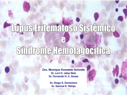 Síndrome hemofagocítica e lúpus eritematoso sistêmico Dra. Monique
