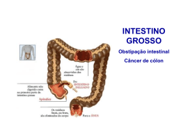 INTESTINO GROSSO Obstipação intestinal Câncer de cólon O