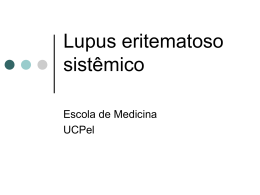 Lupus eritematoso sistêmico